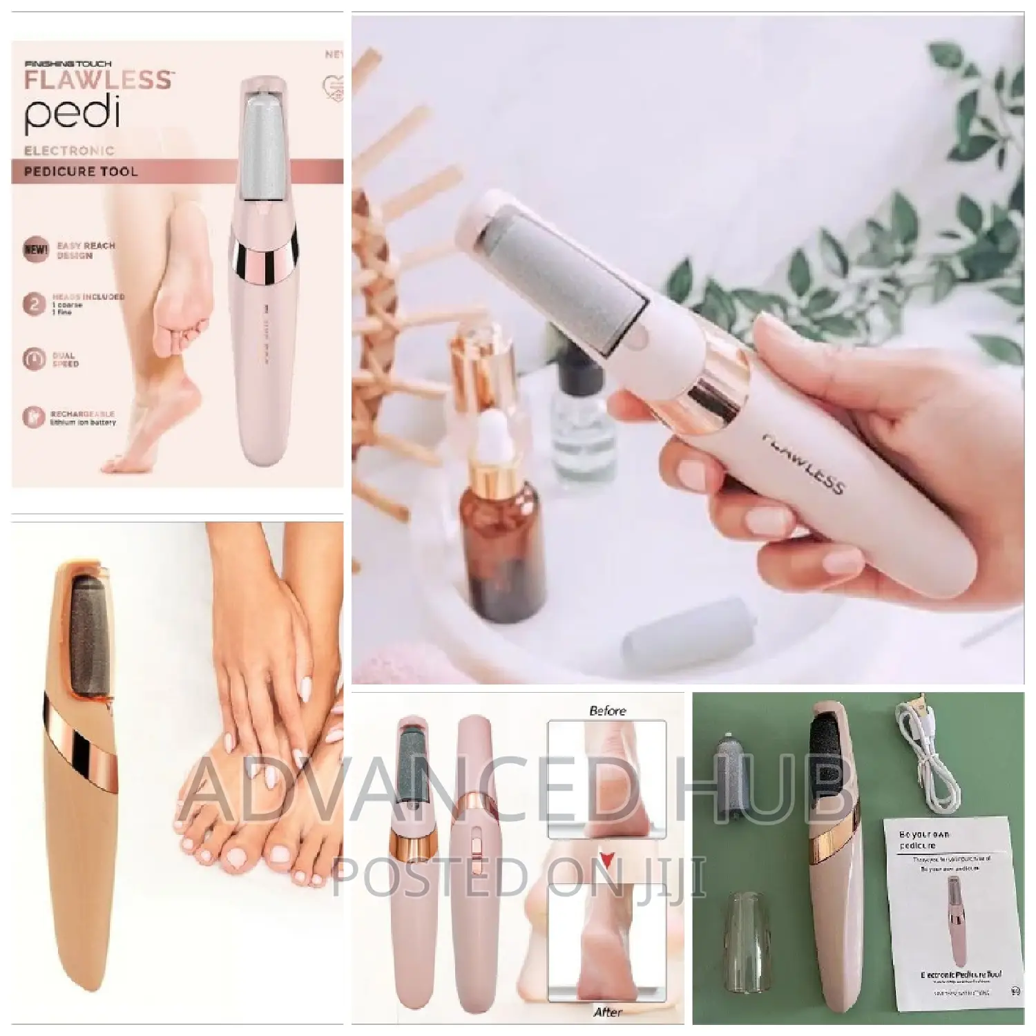 New Electric Cordless Callous Remover