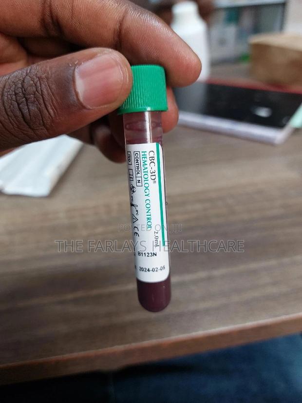 Hematology Control - main view