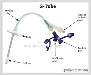 G-Tube/ Gastrostomy Feeding Tube