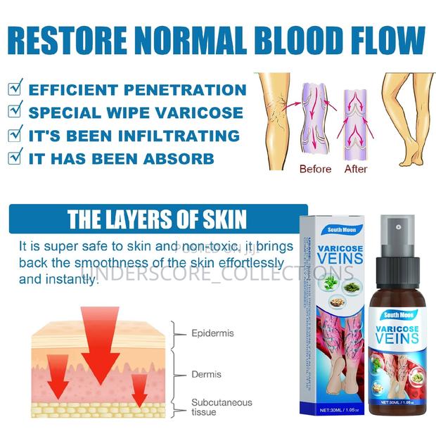 Southmoon Varicose Vein Remover - thumbnail 4