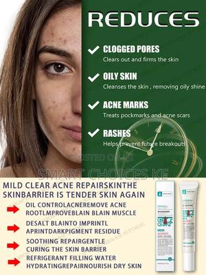 *Herbal Anti Acne CreamFade Acne Marks - main view