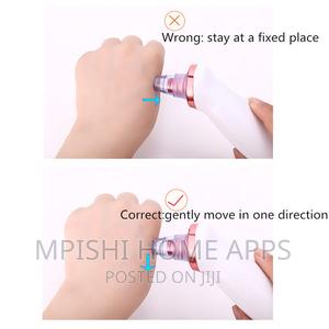 Microcrystalline Blackhead Remover - thumbnail 2