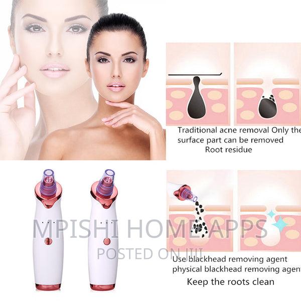 Microcrystalline Blackhead Remover - thumbnail 5