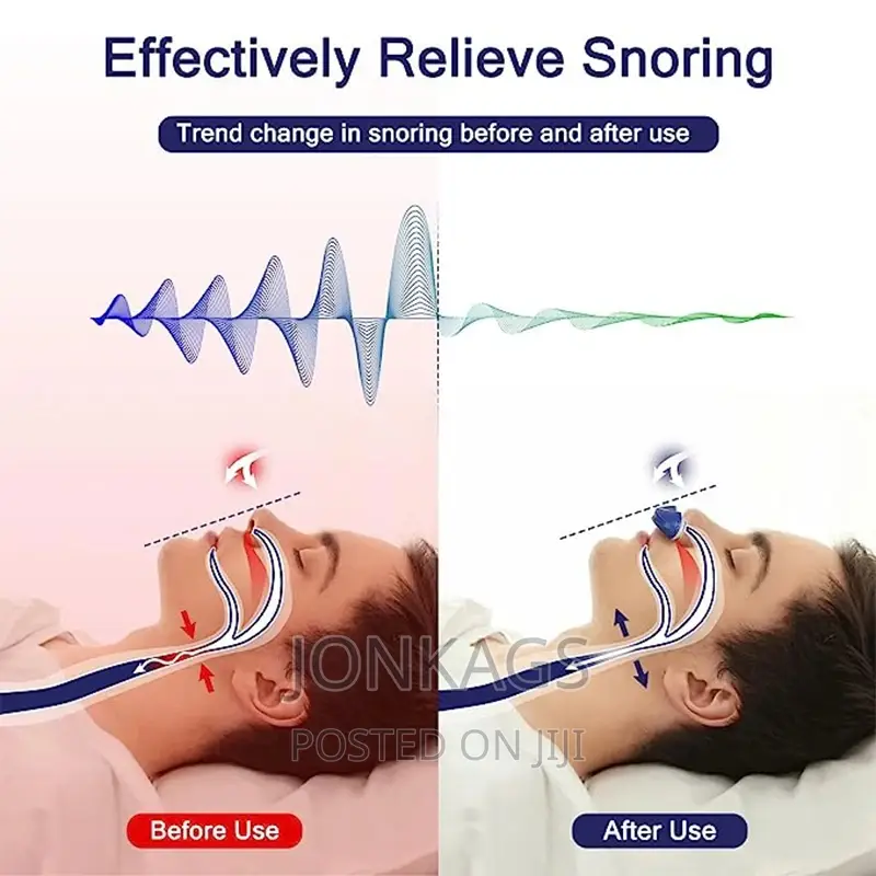 Electric Anti Snore Turbo