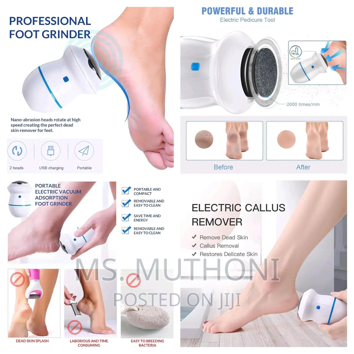 Find Back Rechargeable Callus Remover