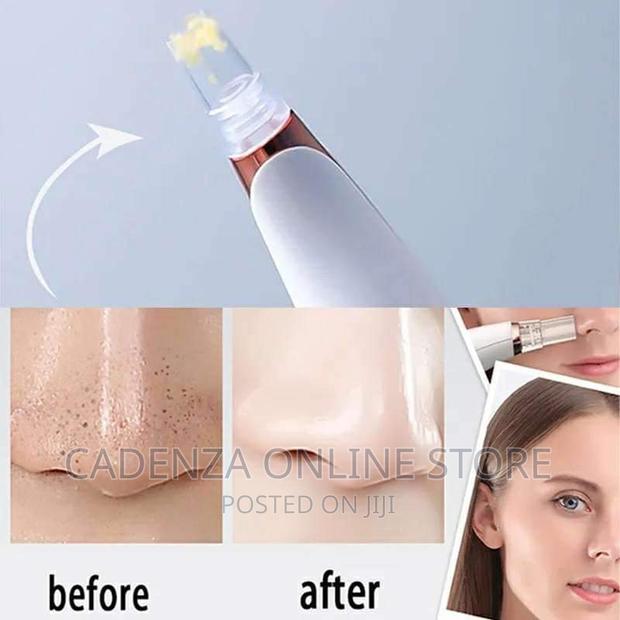 Facial Cleansing Device - thumbnail 6