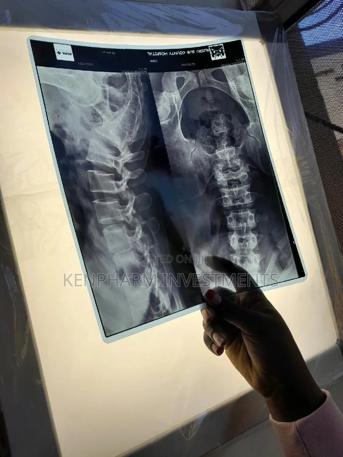 X-Ray Film Viewer》Single
