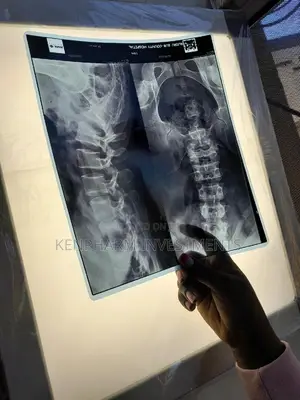 X-Ray Film Viewer》Single
