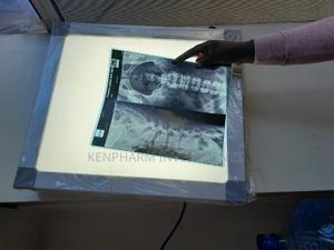 LED Xray Film Viewer Box Single - thumbnail 2