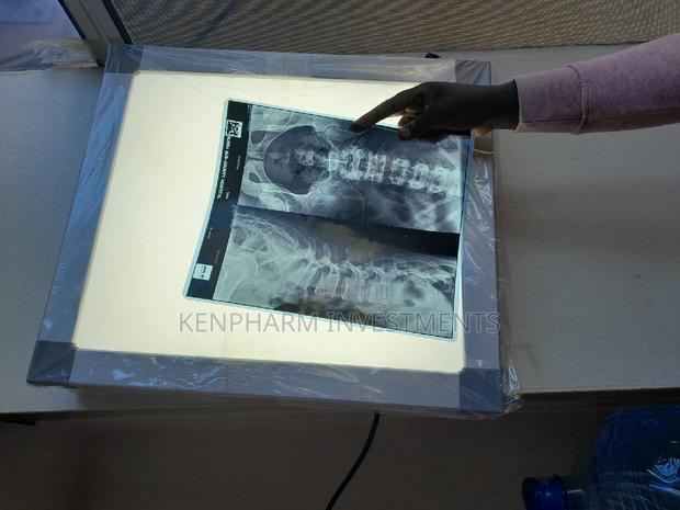 LED Xray Film Viewer Box Single - main view