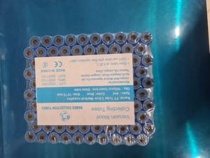Blue Top Vacutainer. - thumbnail 2