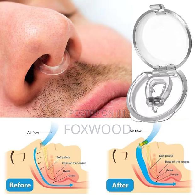 *Anti-Snoring Device - main view