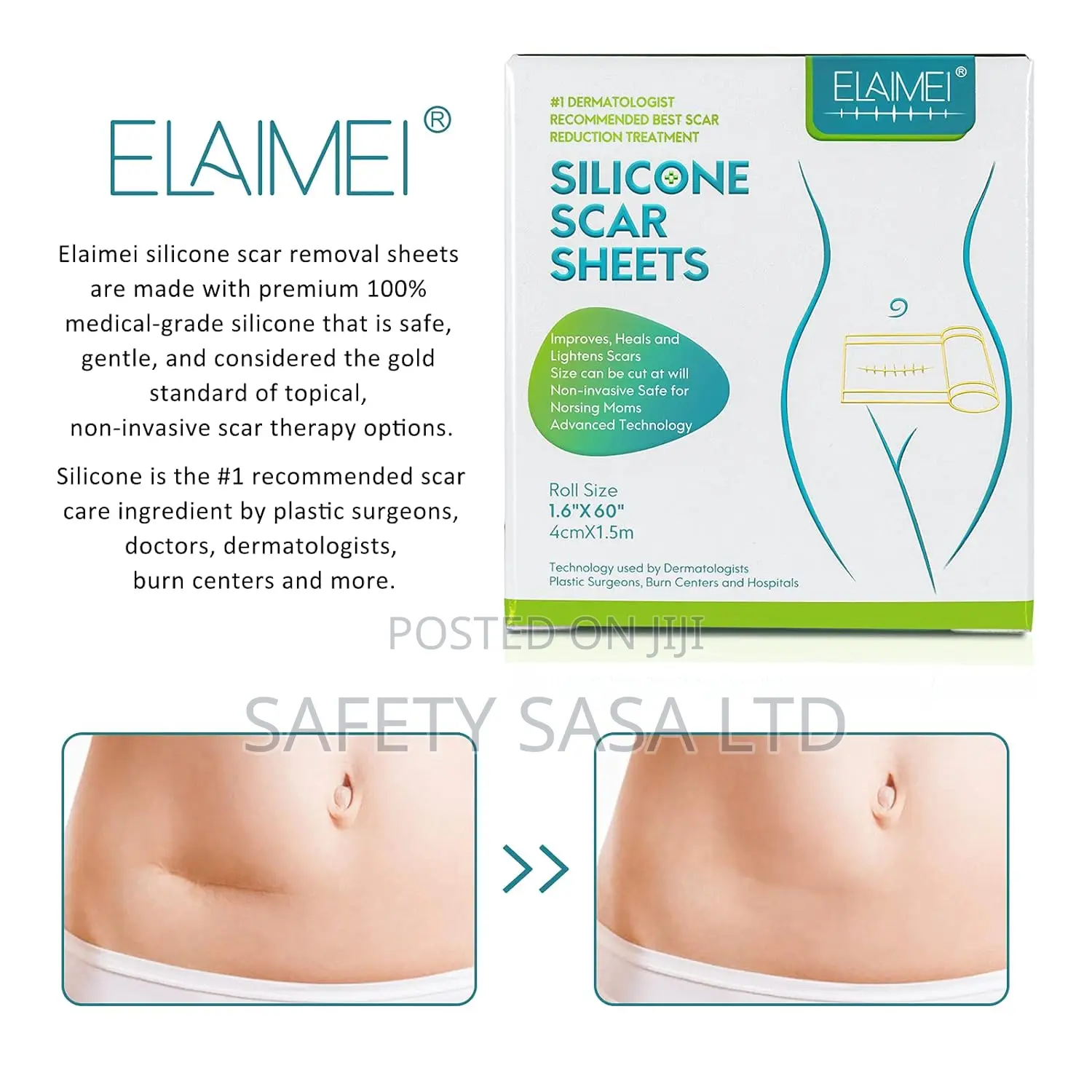 Medical Grade Silicone Scar Sheets