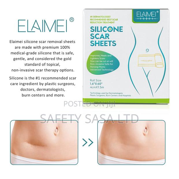 Medical Grade Silicone Scar Sheets - thumbnail 2