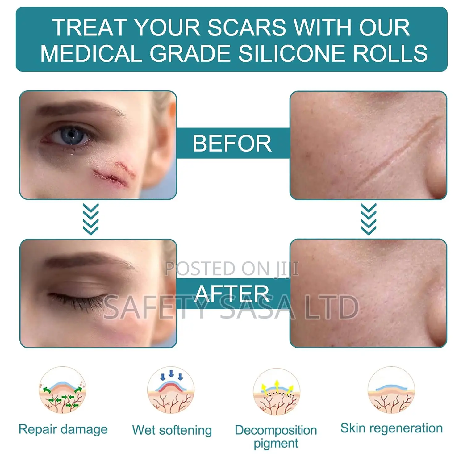 Medical Grade Silicone Scar Sheets