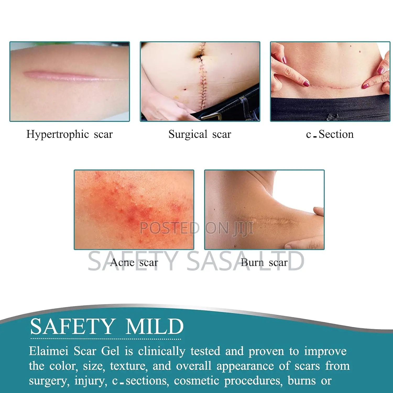 Medical Grade Silicone Scar Sheets