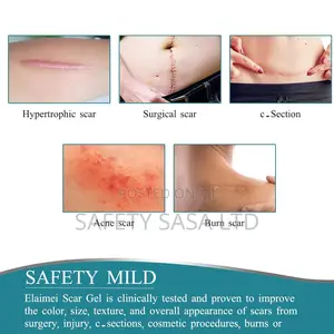 Medical Grade Silicone Scar Sheets