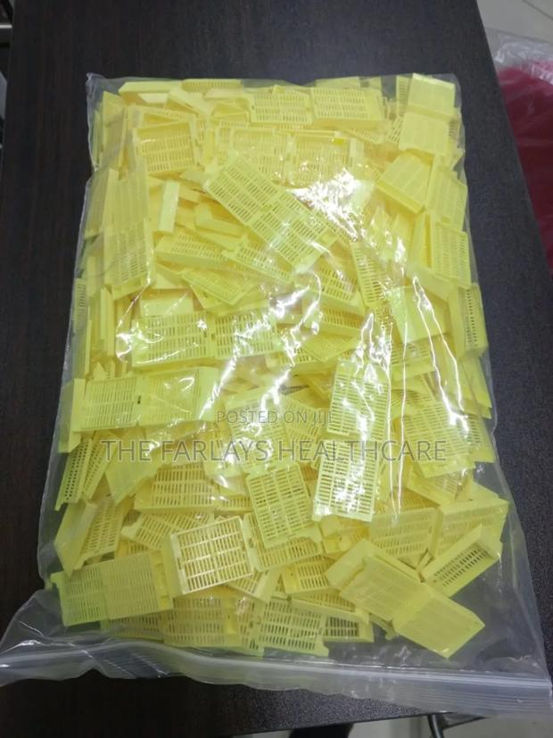 Embedded Cassettes Yellow - Straight.