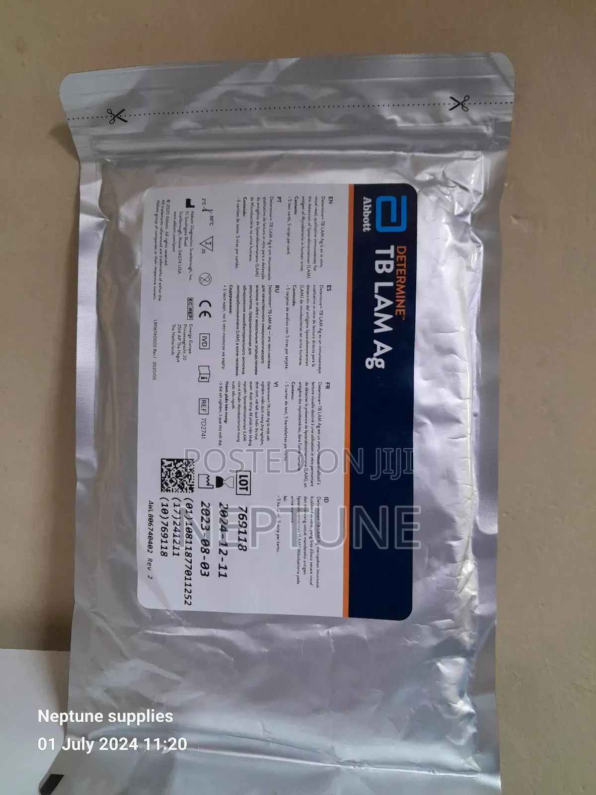 Tuberclosis/Tb LAM Ag