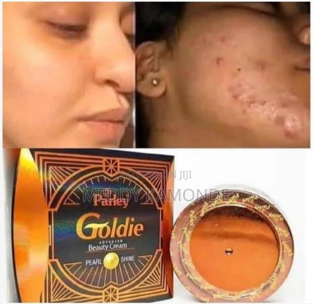 Pimple Remover Soaps/Acne Soaps - main view