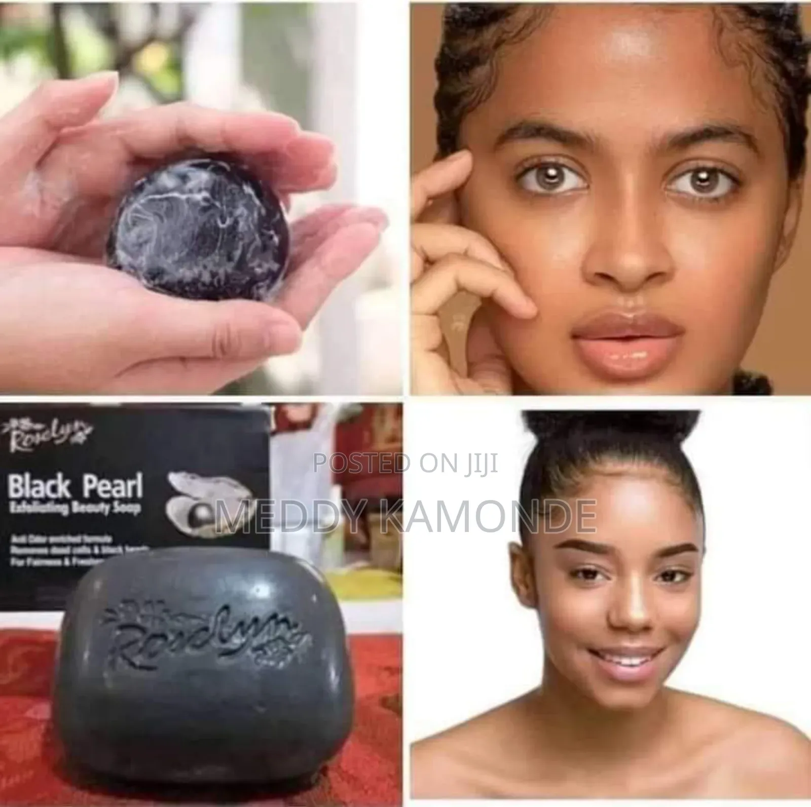 Pimple Remover Soaps/Acne Soaps
