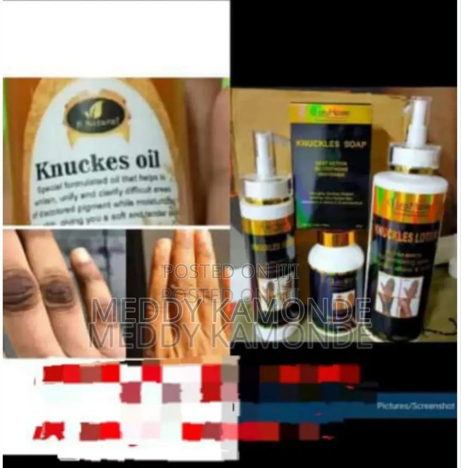 Quality Knuckles Oil/Cream
