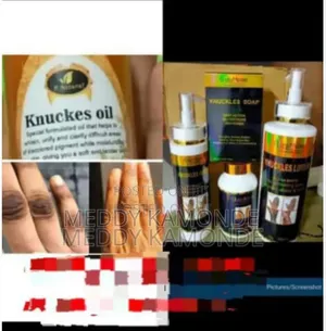 Quality Knuckles Oil/Cream