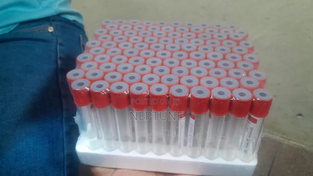 10ml Redtop Vacutinner