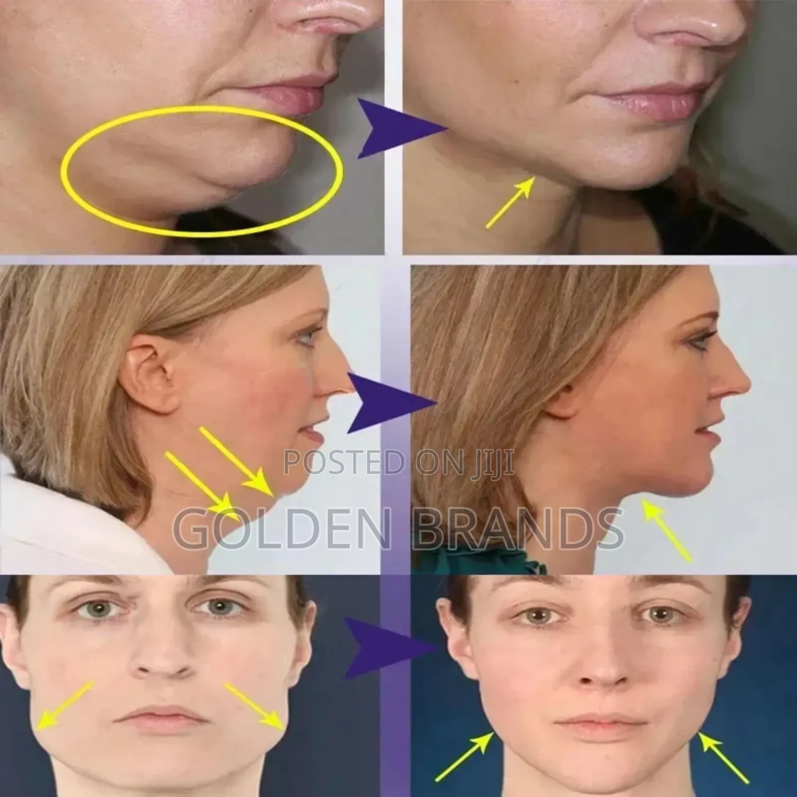 V-Shape Face Slimming Cream Remove Double Chins Firming Lift