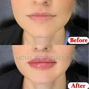 6pc Natural Plant Lip Balm Anti-Cracking Lip Oil