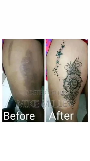 Temporary Scar Cover Up