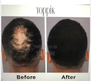 Toppik Hair Building Fiber 27.5g ( Black and Dark Brown)