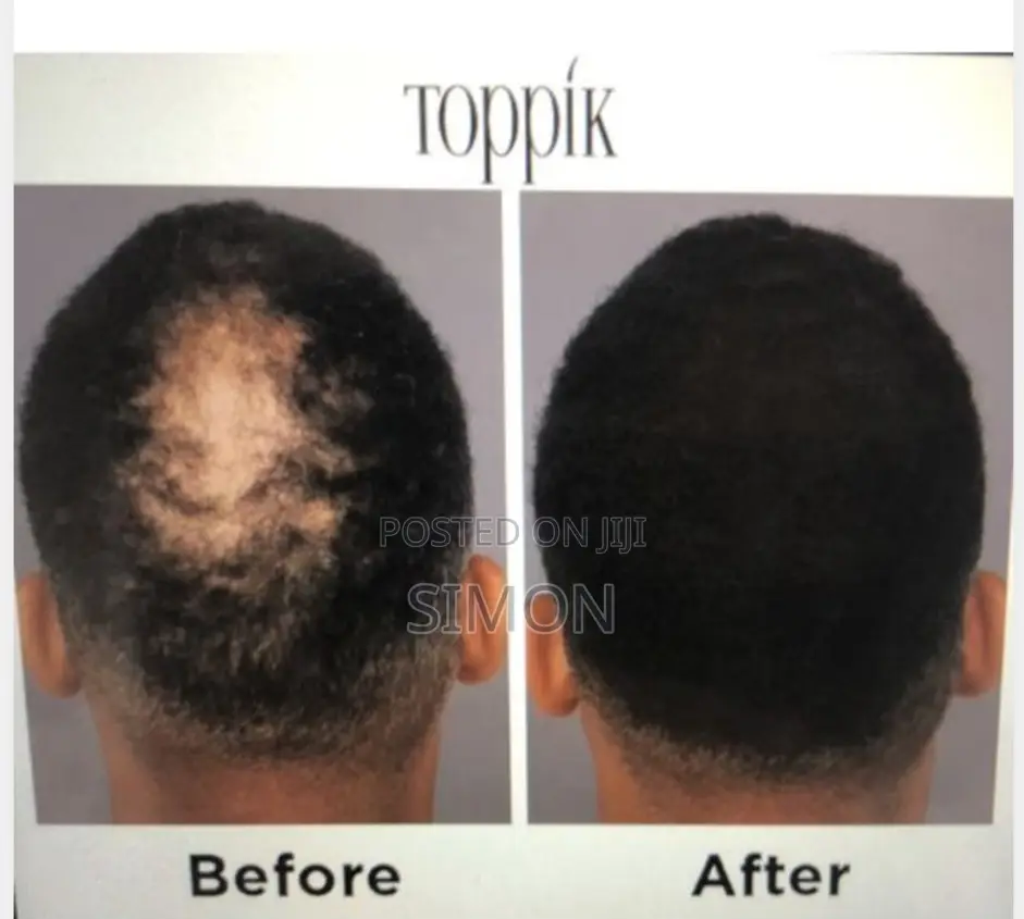 Toppik Hair Building Fiber 27.5g ( Black and Dark Brown)