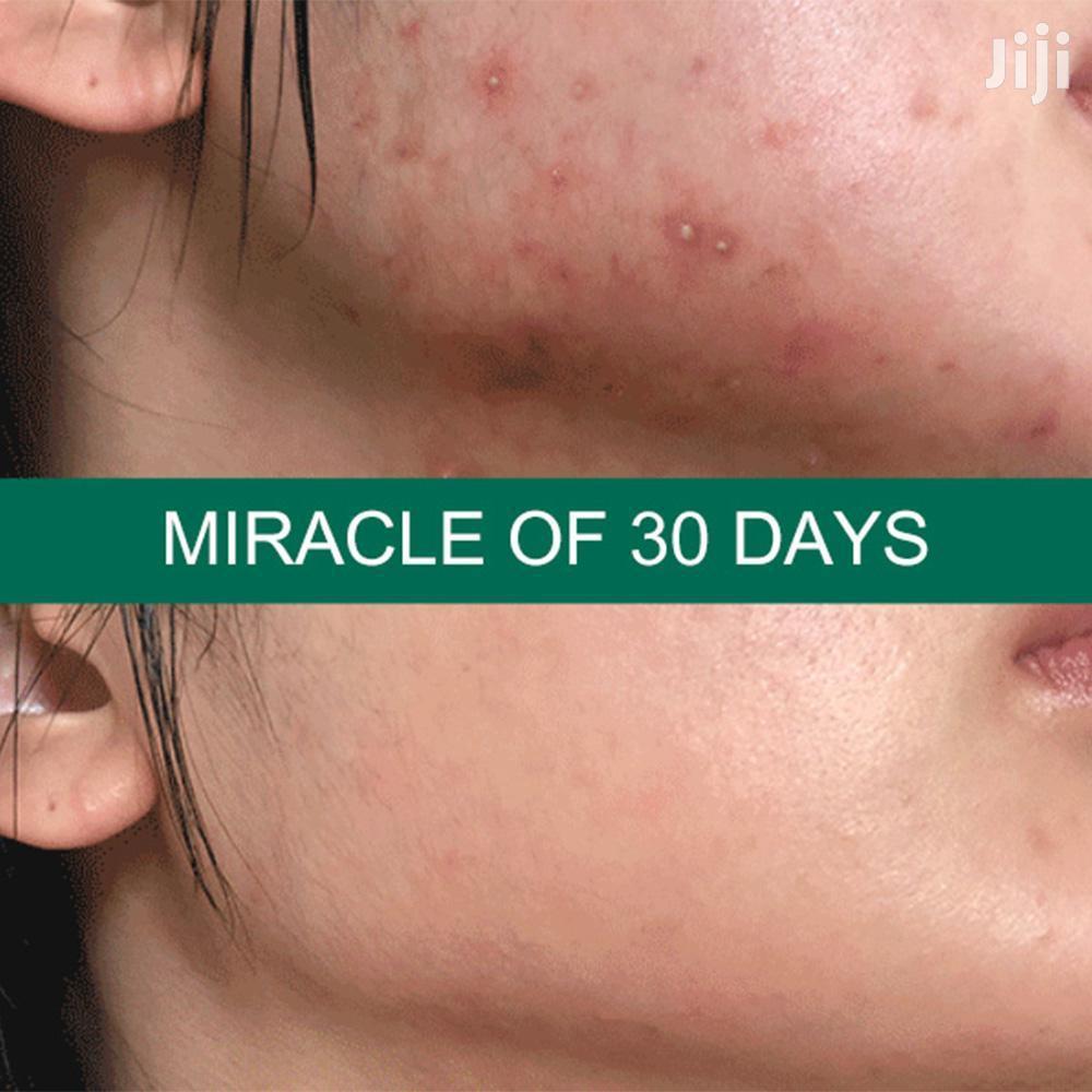 Roushun Aha Bha Pha 30 Days Miracle Toner