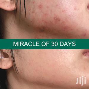 Roushun Aha Bha Pha 30 Days Miracle Toner