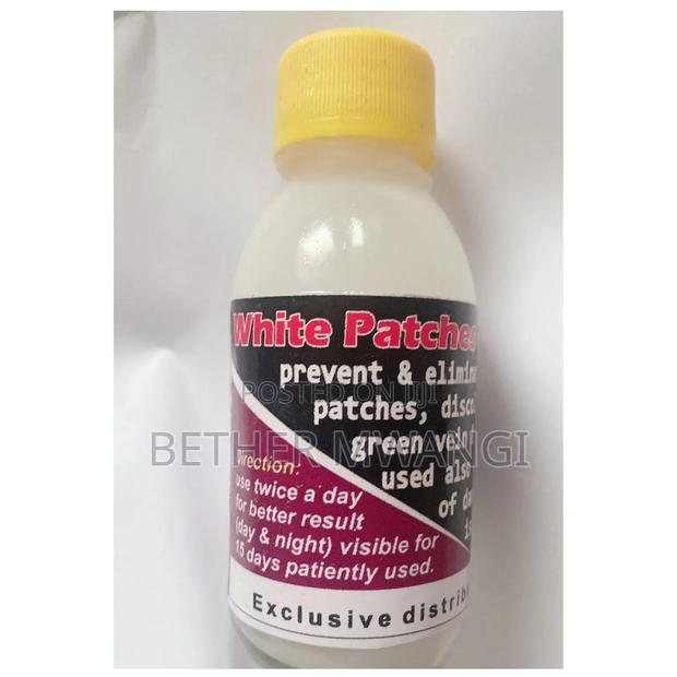 White Patches Remover Oil in Kenya - thumbnail 2