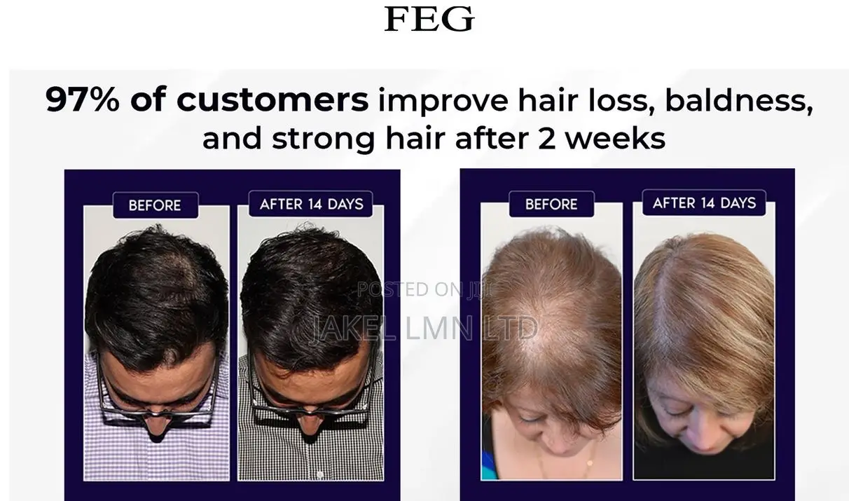 Feg Hair Growth Spray - 50 Ml