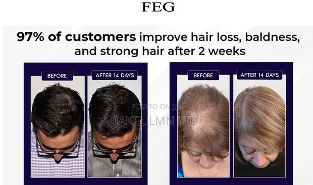 Feg Hair Growth Spray - 50 Ml - thumbnail 6