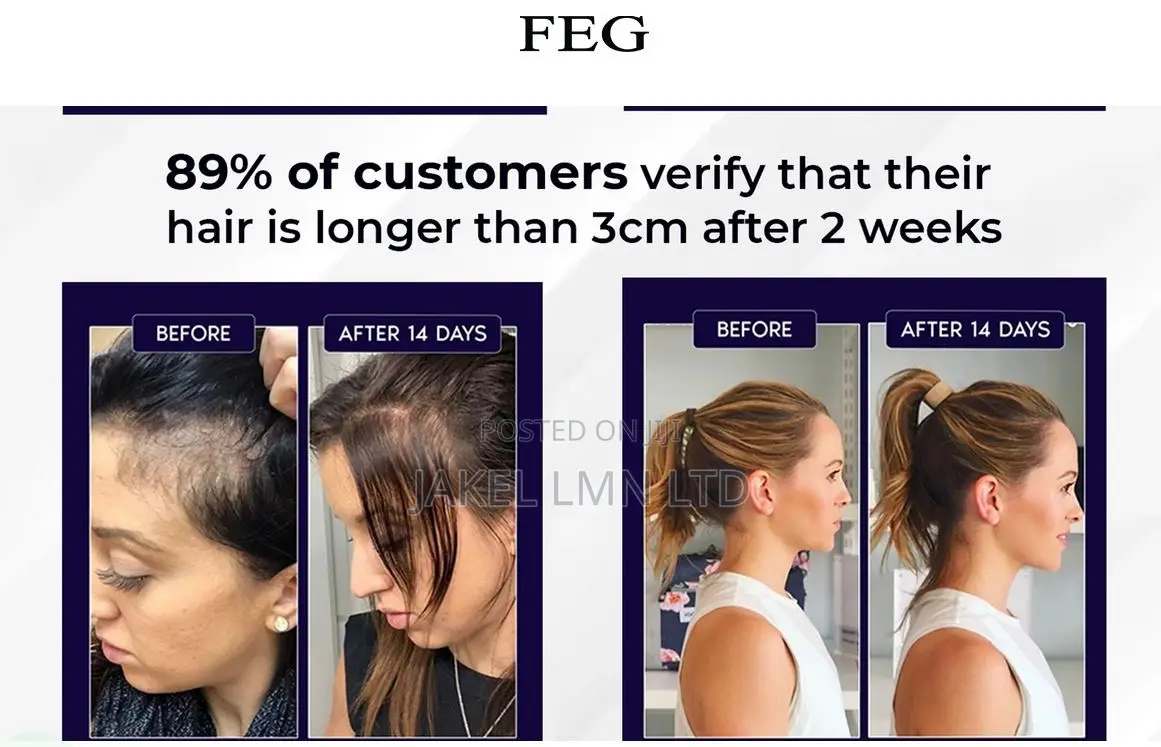 Feg Hair Growth Spray - 50 Ml