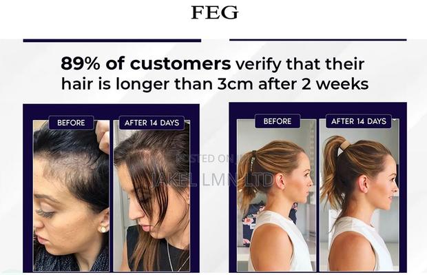 Feg Hair Growth Spray - 50 Ml - thumbnail 7
