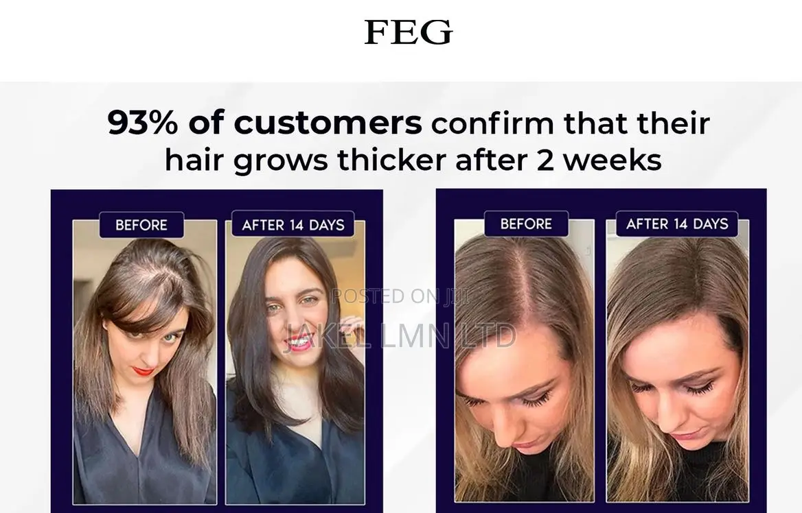 Feg Hair Growth Spray - 50 Ml