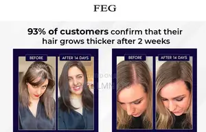 Feg Hair Growth Spray - 50 Ml