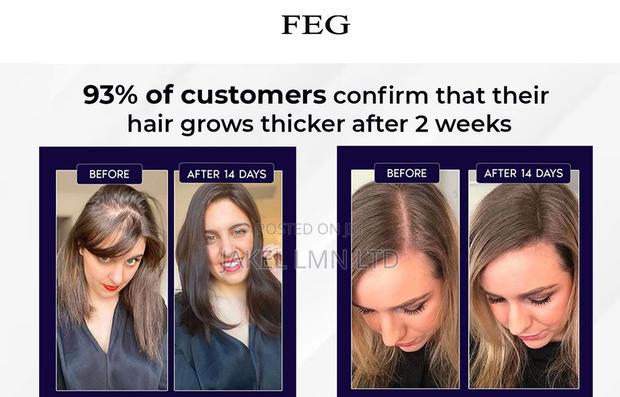 Feg Hair Growth Spray - 50 Ml - thumbnail 5