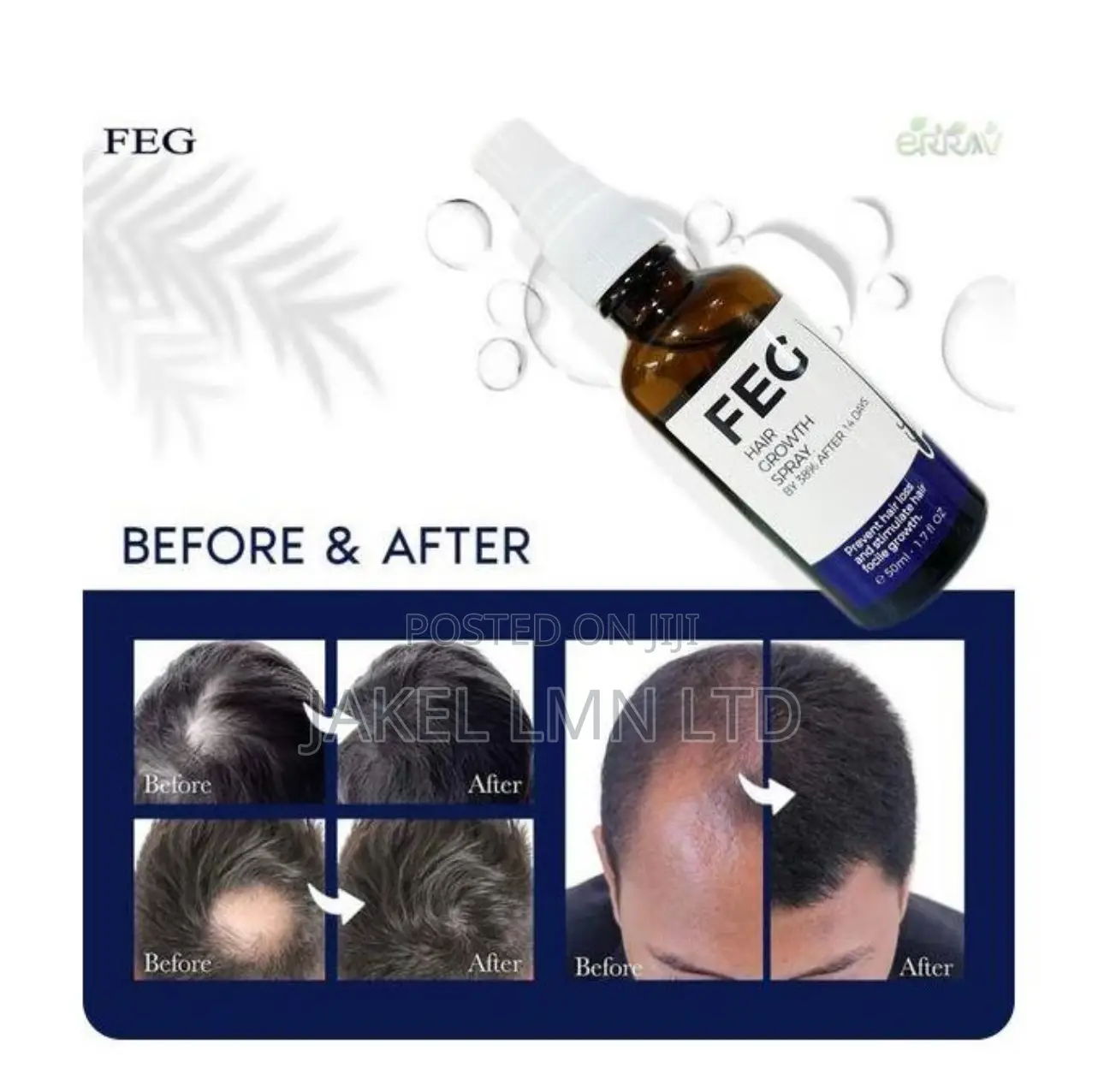Feg Hair Growth Spray - 50 Ml