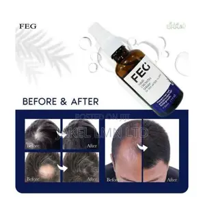 Feg Hair Growth Spray - 50 Ml