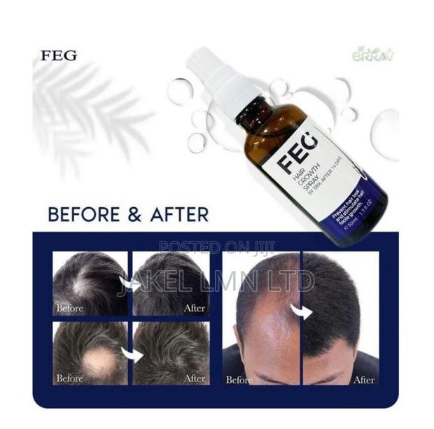 Feg Hair Growth Spray - 50 Ml - thumbnail 2