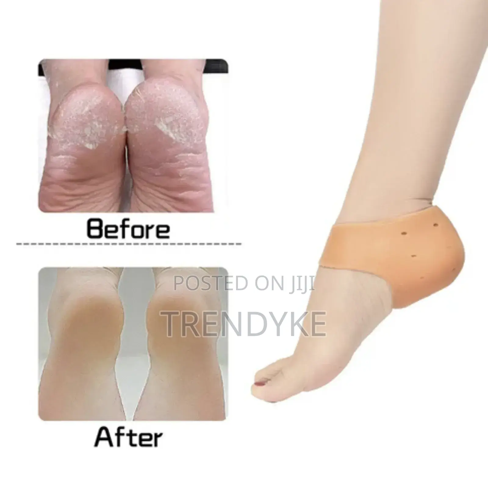 Heel Anti Crack