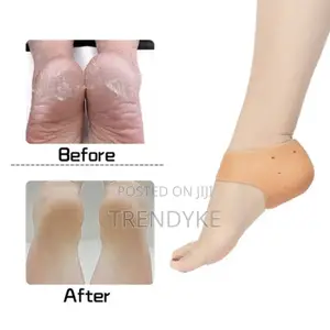 Heel Anti Crack