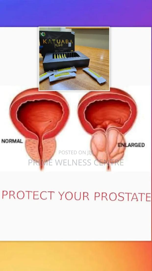 Brazillian Katuaba - thumbnail 4