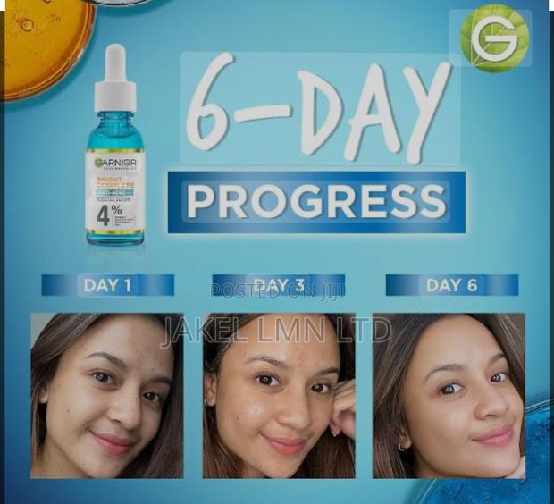 Garnier Bright Complete Anti-Acne Booster Serum -30ml - thumbnail 4
